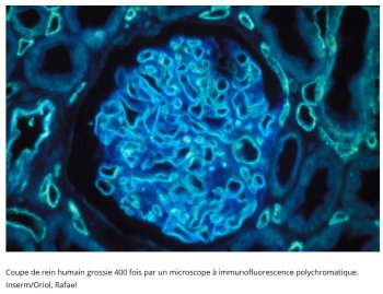 Une chute considérable du nombre de greffes d’organes depuis le début de la pandémie de COVID-19 dans le monde 