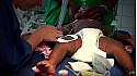 ALMOHA en mission humanitaire de chirurgie des malformations rares et congénitales à Yaoundé. (Cameroun)